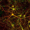 Из искусственных стволовых клеток получены нейроны
